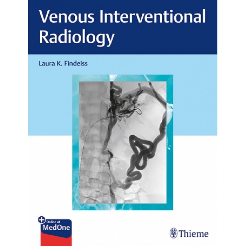 Venous Interventional Radiology