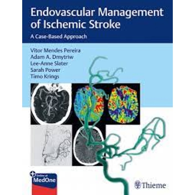  Endovascular Management of Ischemic Stroke A Case-Based Approach