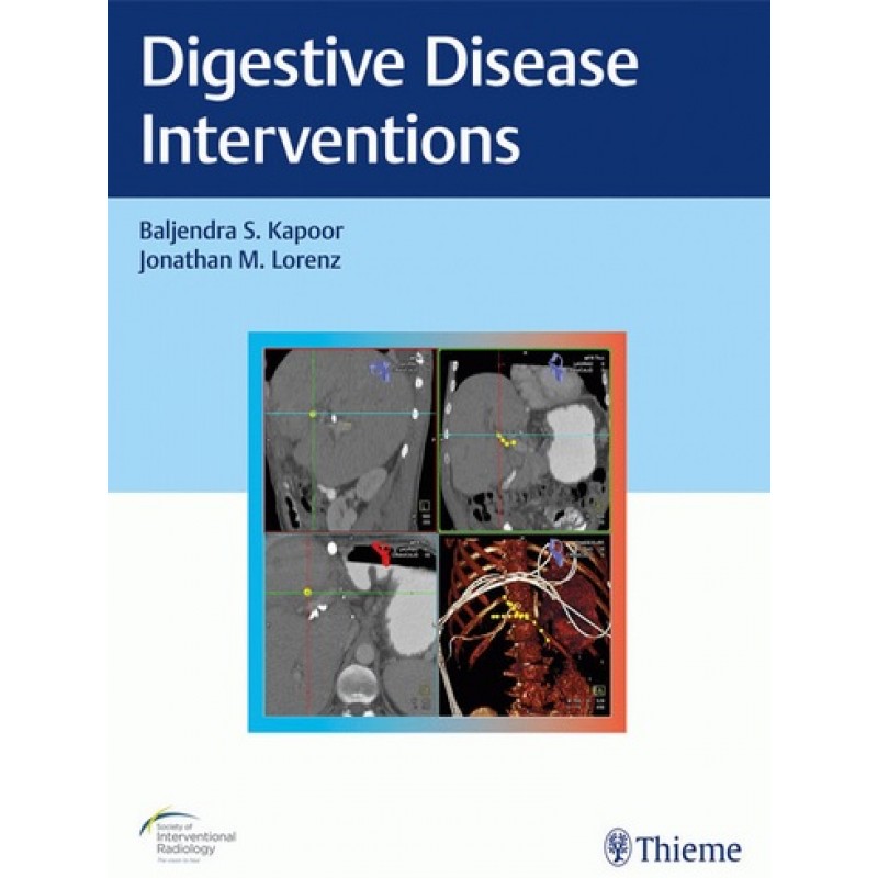 Digestive Disease Interventions