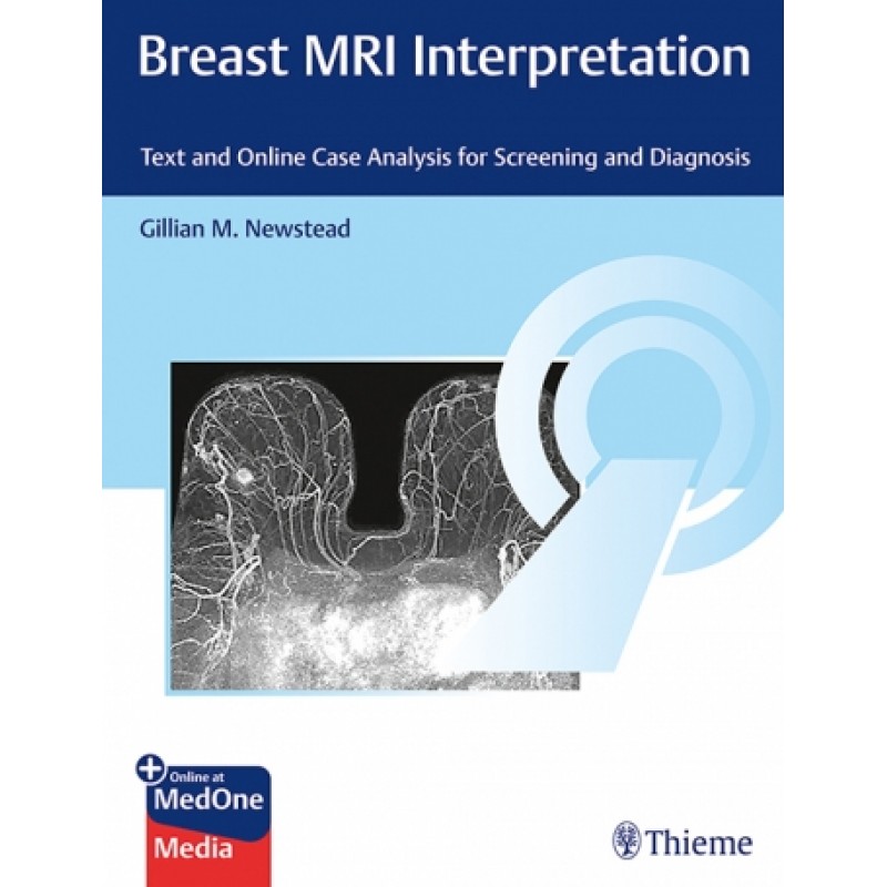 Breast MRI Interpretation - Text and Online Case Analysis for Screening and Diagnosis 