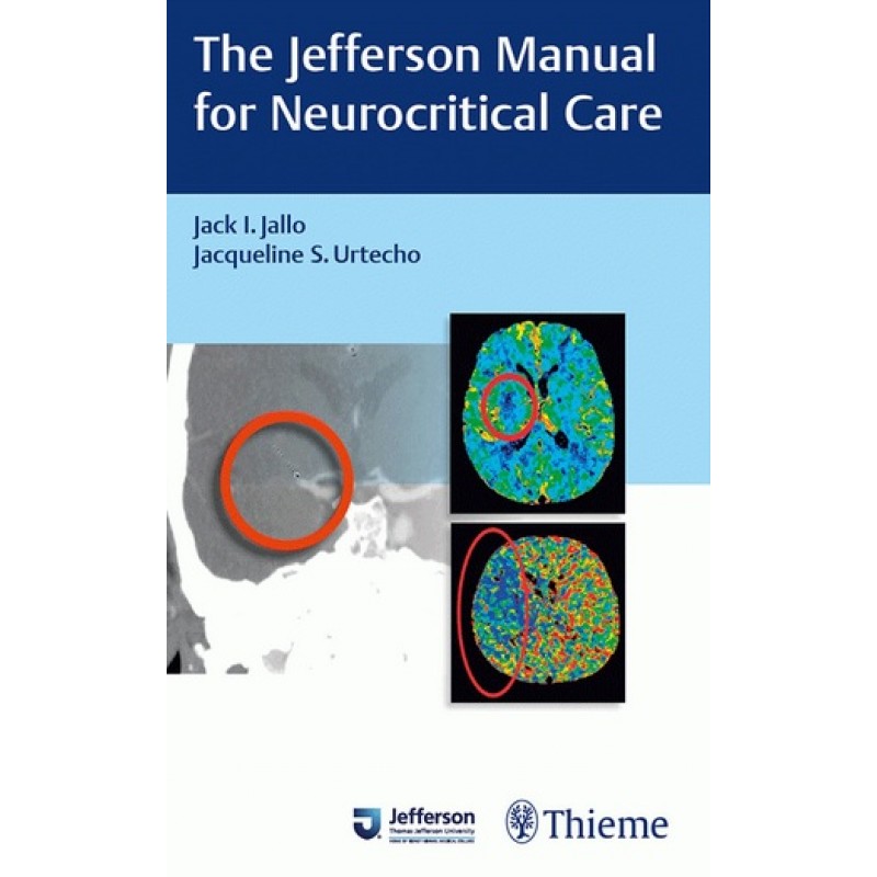 The Jefferson Manual for Neurocritical Care