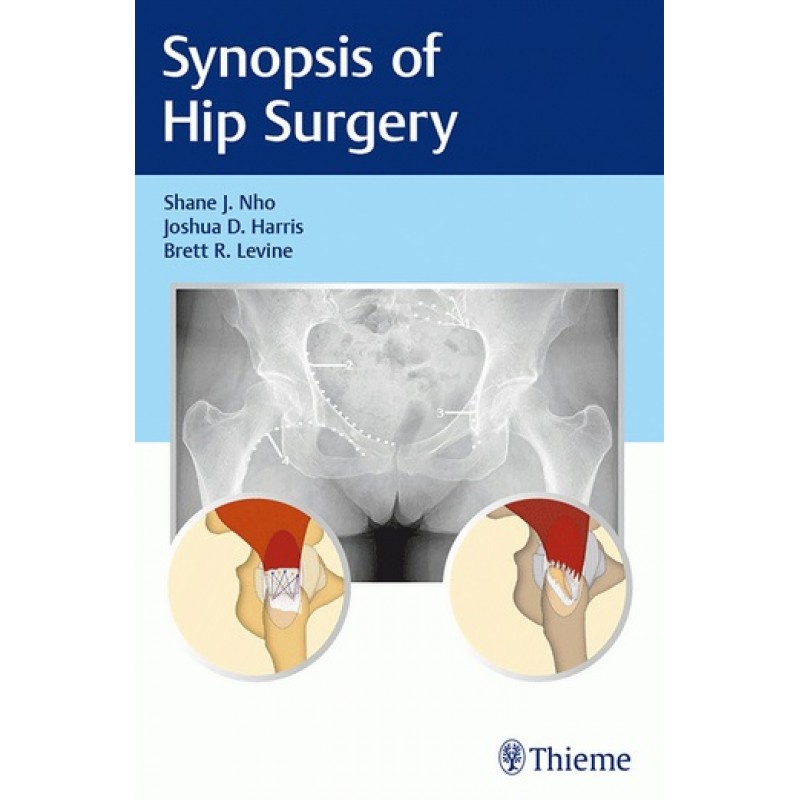 Synopsis of Hip Surgery