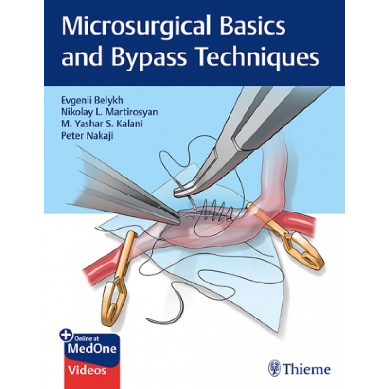 Microsurgical Basics and Bypass Techniques