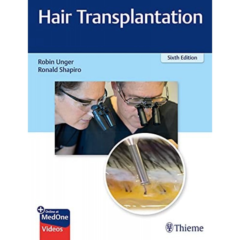  Hair Transplantation 