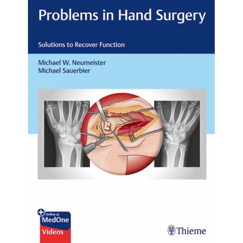 Problems in Hand Surgery - Solutions to Recover Function 