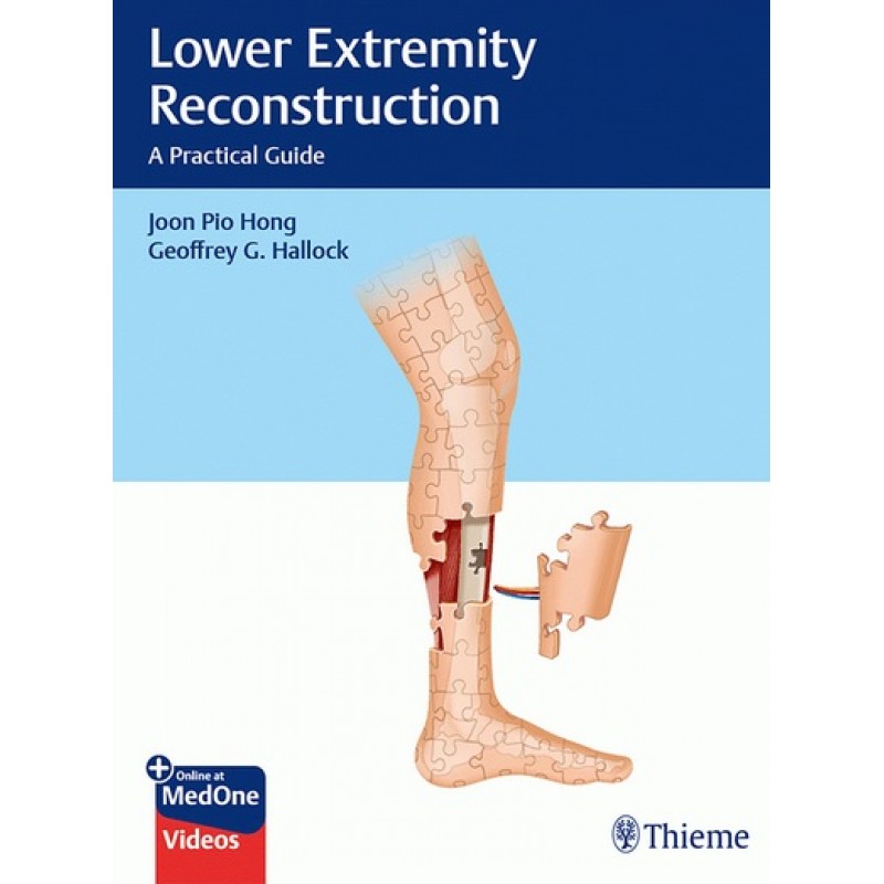 Lower Extremity Reconstruction: A Practical Guide 