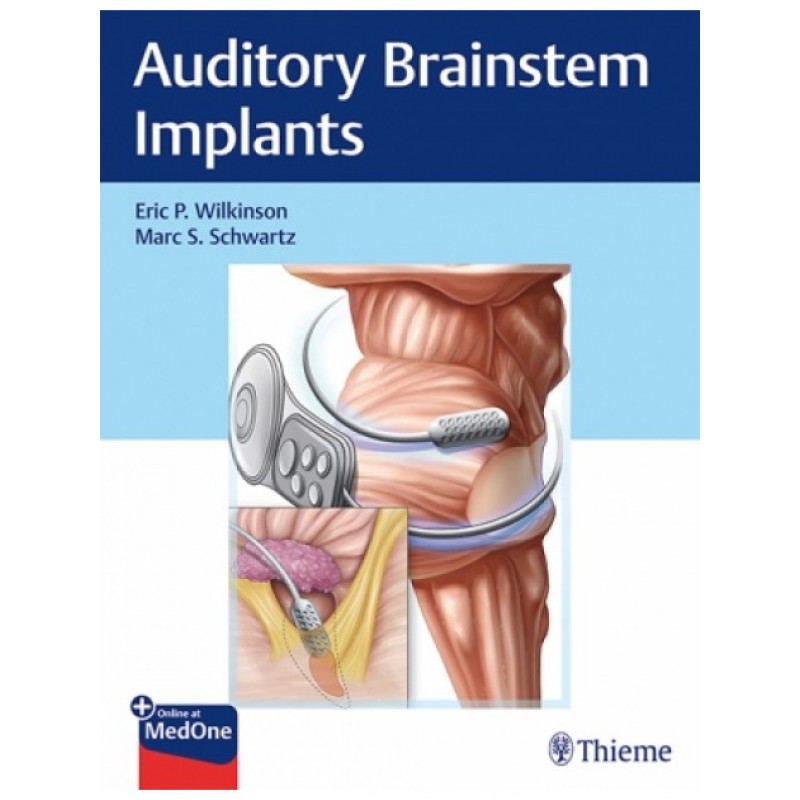 Auditory Brainstem Implants