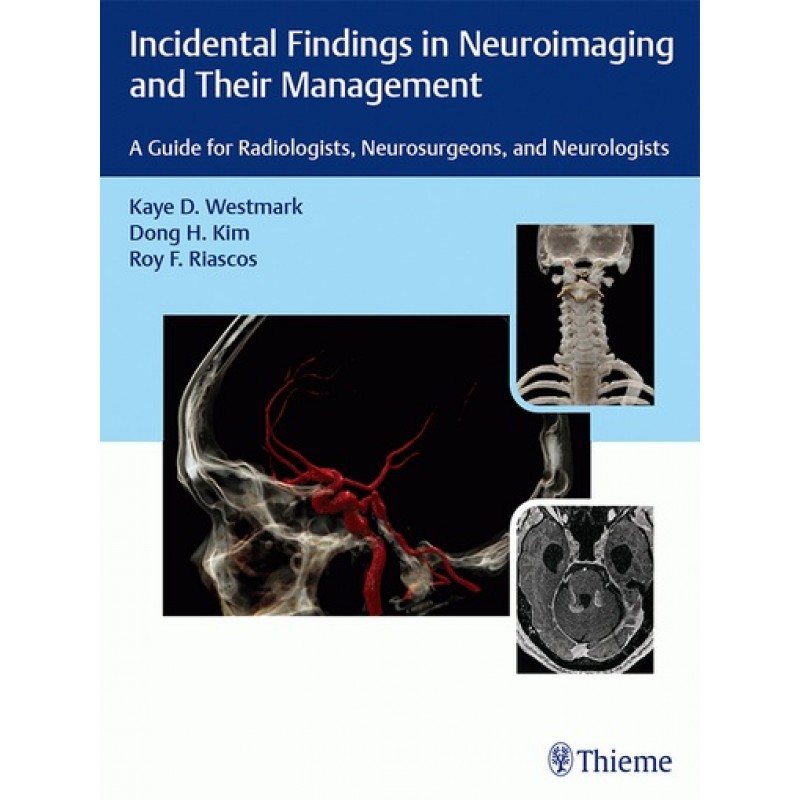 Incidental Findings in Neuroimaging and Their Management: A Guide for Radiologists, Neurosurgeons, and Neurologists 