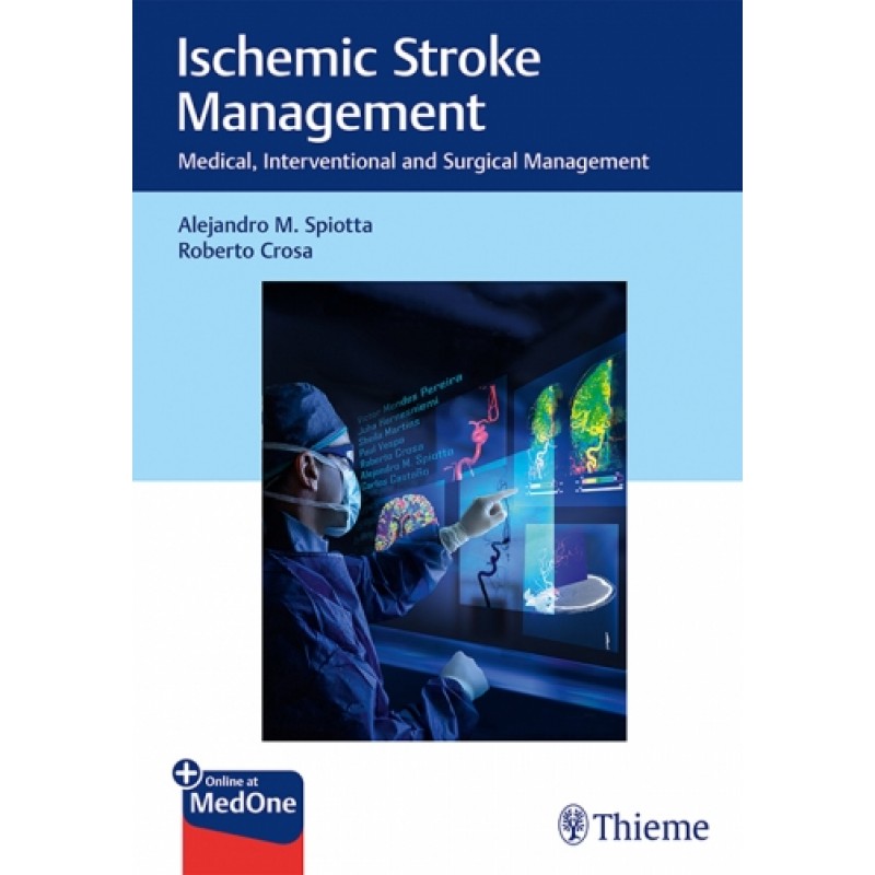 Ischemic Stroke Management