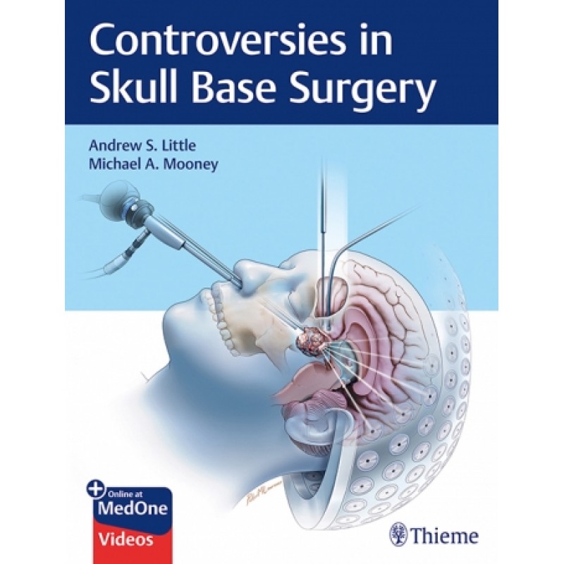 Controversies in Skull Base Surgery