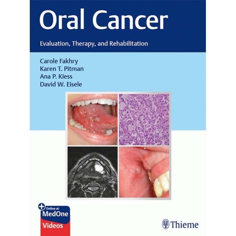 Oral Cancer: Evaluation, Therapy, and Rehabilitation 