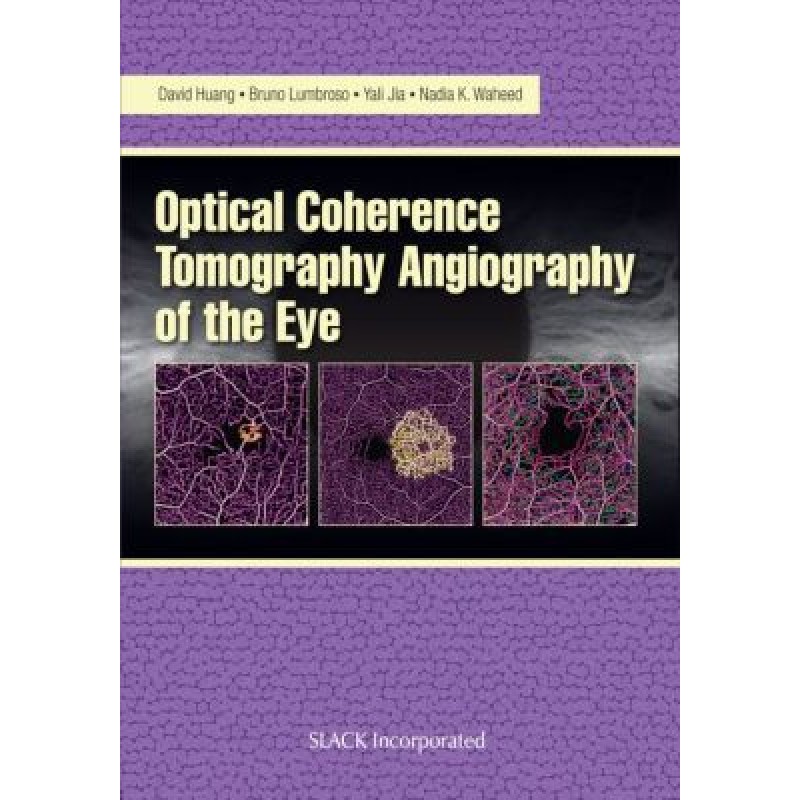 Optical Coherence Tomography Angiography of the Eye