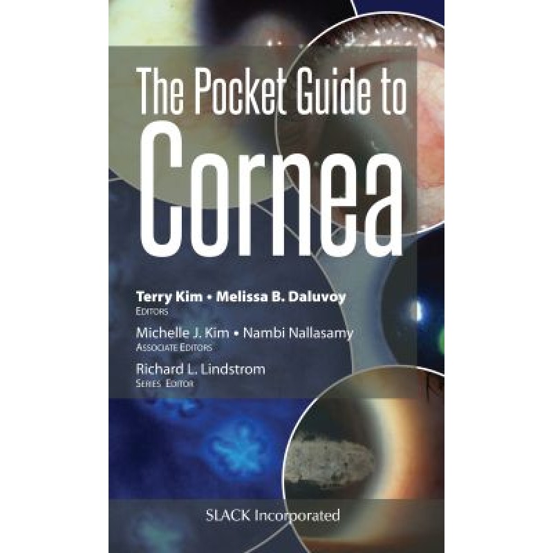 The Pocket Guide to Cornea