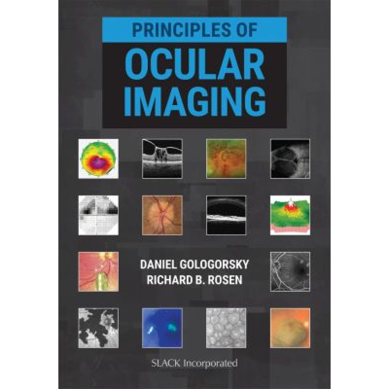 Principles of Ocular Imaging 