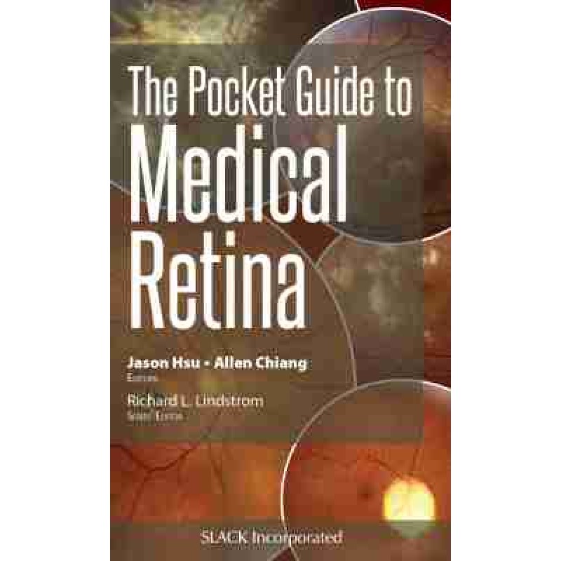 The Pocket Guide to Medical Retina