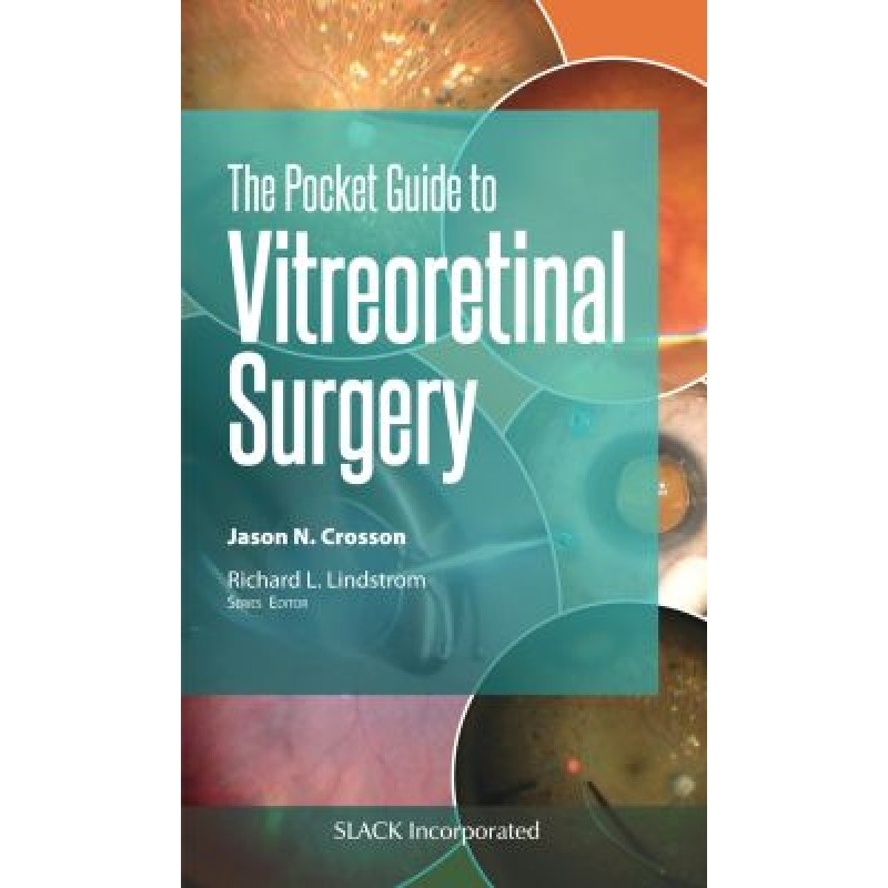 The Pocket Guide to Vitreoretinal Surgery