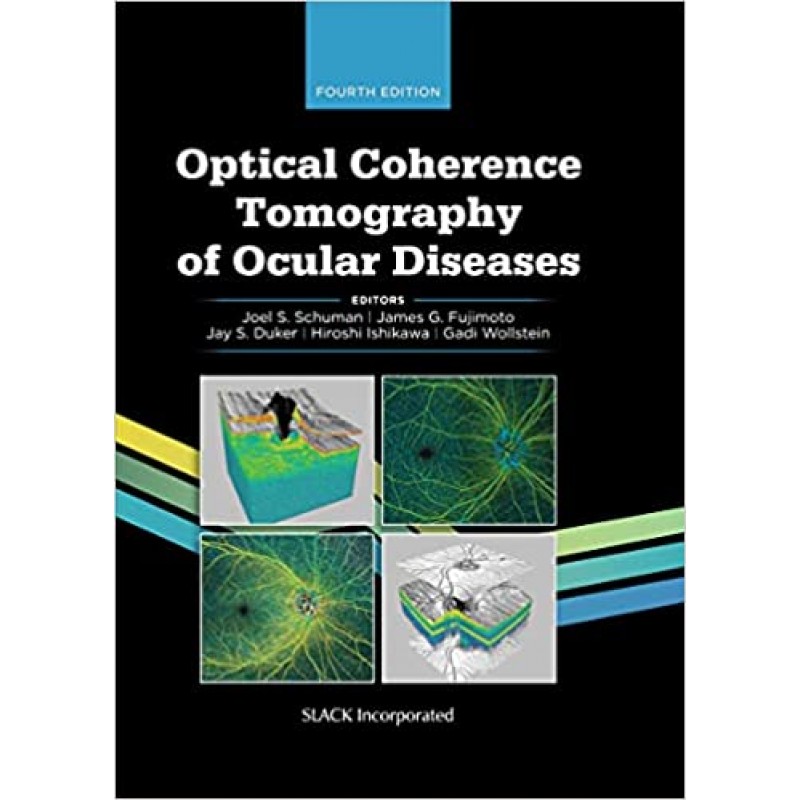 Optical Coherence Tomography of Ocular Diseases, 4E