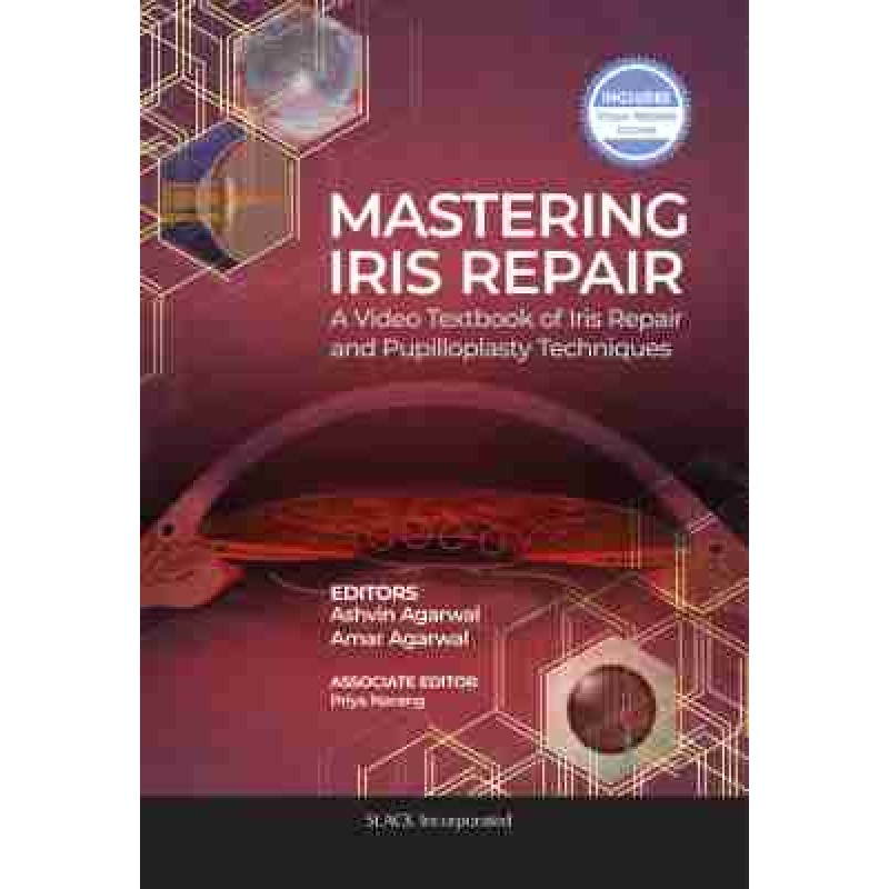 Mastering Iris Repair A Video Textbook of Iris Repair and Pupilloplasty Techniques