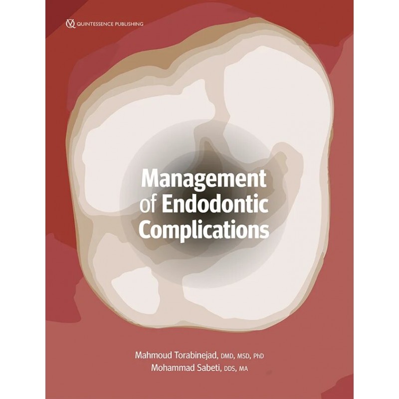 Management of Endodontic Complications, 1st Edition