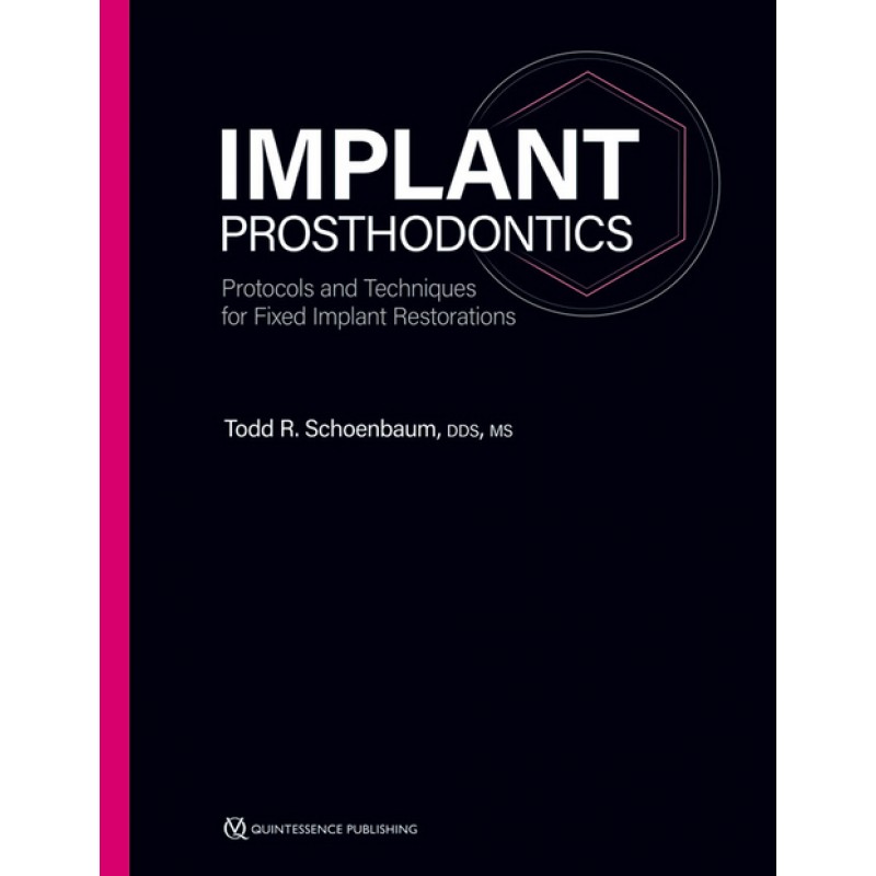 Implant Prosthodontics: Protocols and Techniques for Fixed Implant Restorations