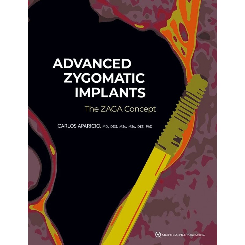 Advanced Zygomatic Implants: The ZAGA Concept, 1st Edition