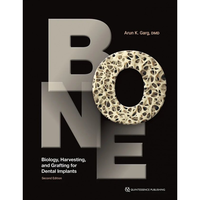 Bone: Biology, Harvesting, and Grafting for Dental Implants, 2nd Edition