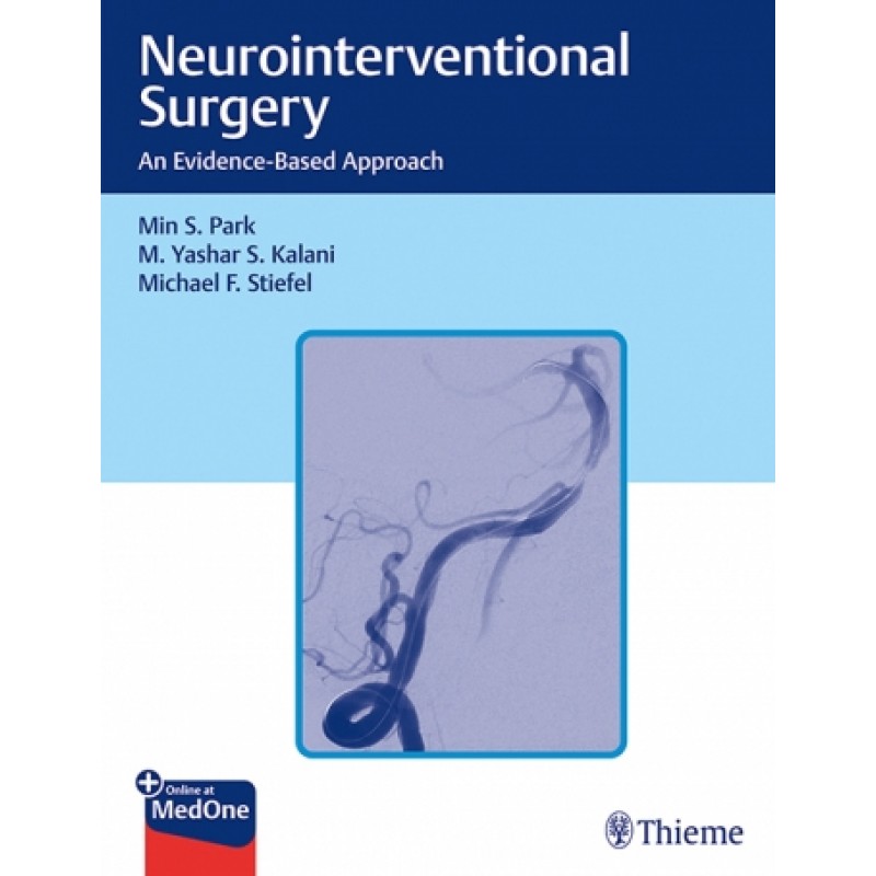  Neurointerventional Surgery An Evidence-Based Approach