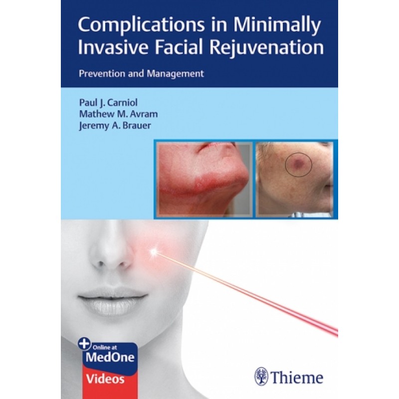 Complications in Minimally Invasive Facial Rejuvenation, Prevention and Management 