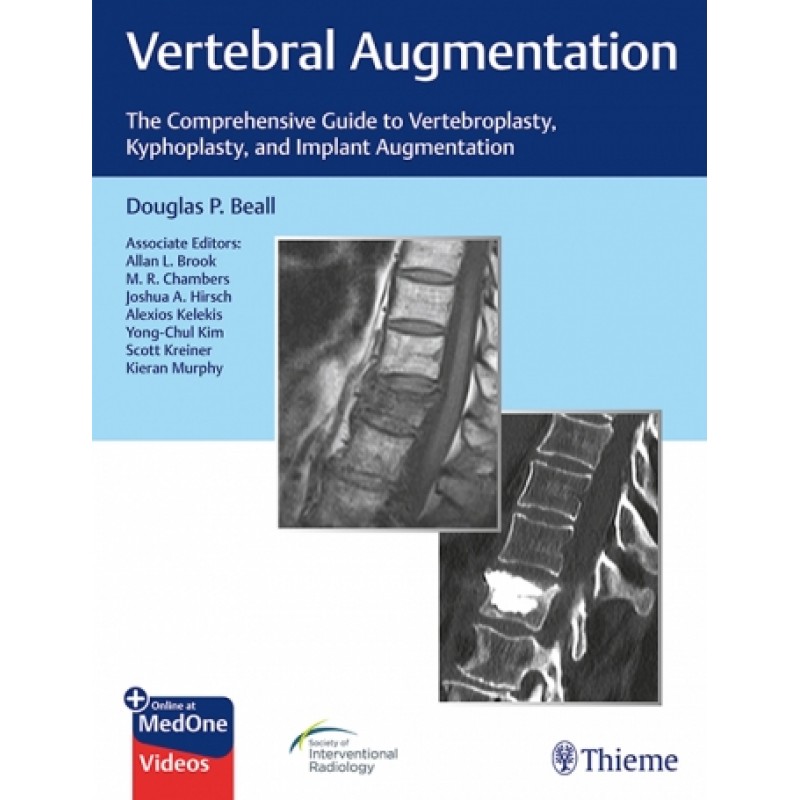 Vertebral Augmentation - The Comprehensive Guide to Vertebroplasty, Kyphoplasty, and Implant Augmentation 