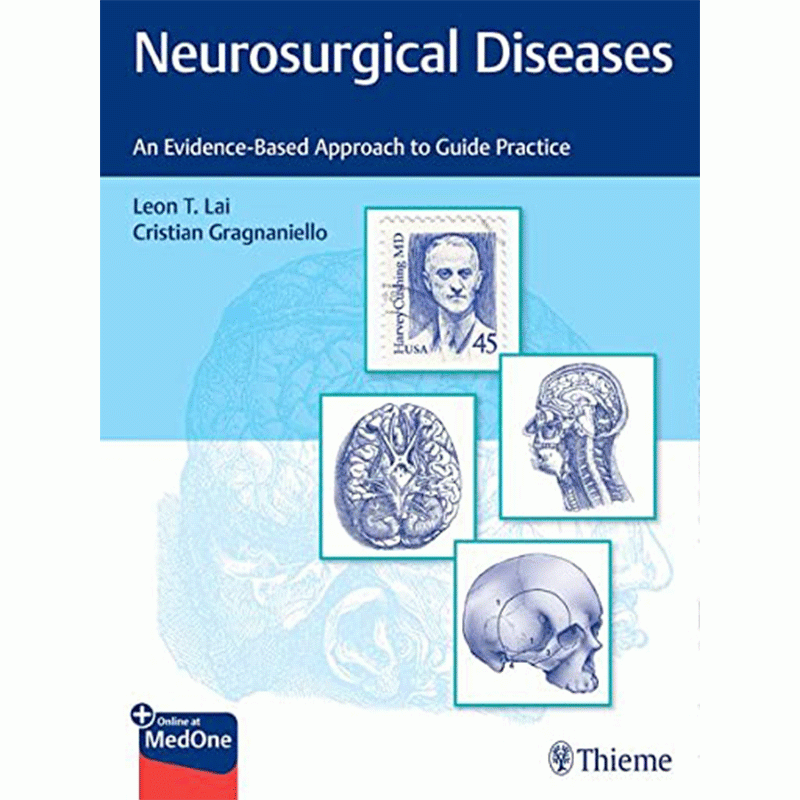 Neurosurgical Diseases: An Evidence-Based Approach to Guide Practice