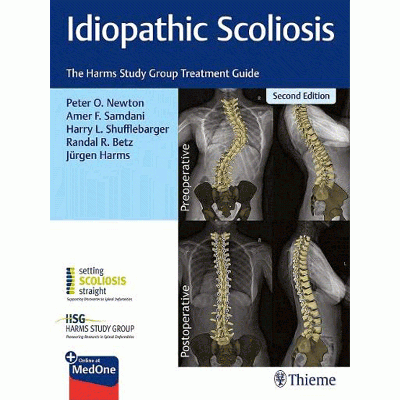 Idiopathic Scoliosis: The Harms Study Group Treatment Guide, 2nd Edition