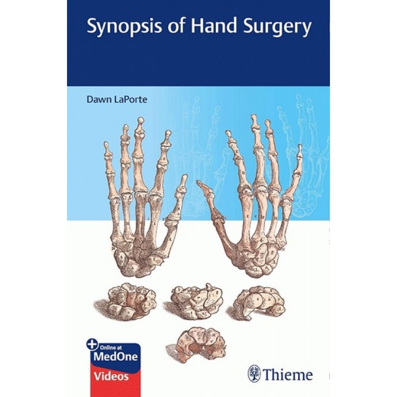 Synopsis of Hand Surgery