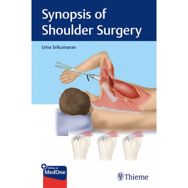 Synopsis of Shoulder Surgery