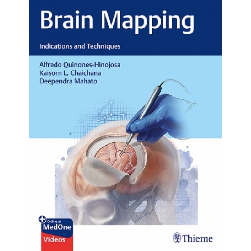 Brain Mapping - Indications and Techniques 