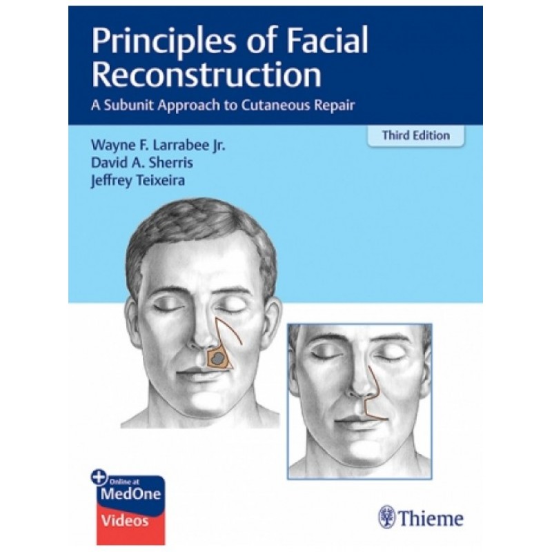  Principles of Facial Reconstruction A Subunit Approach to Cutaneous Repair