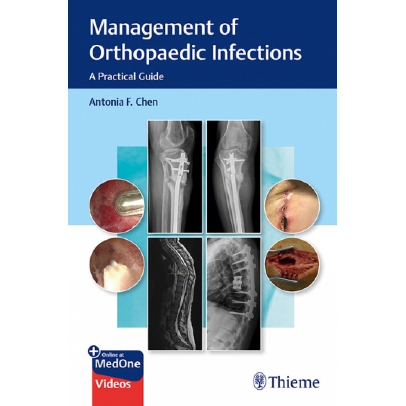 Management of Orthopaedic Infections: A Practical Guide 