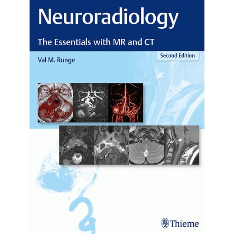 Neuroradiology The Essentials with MR and CT 2E