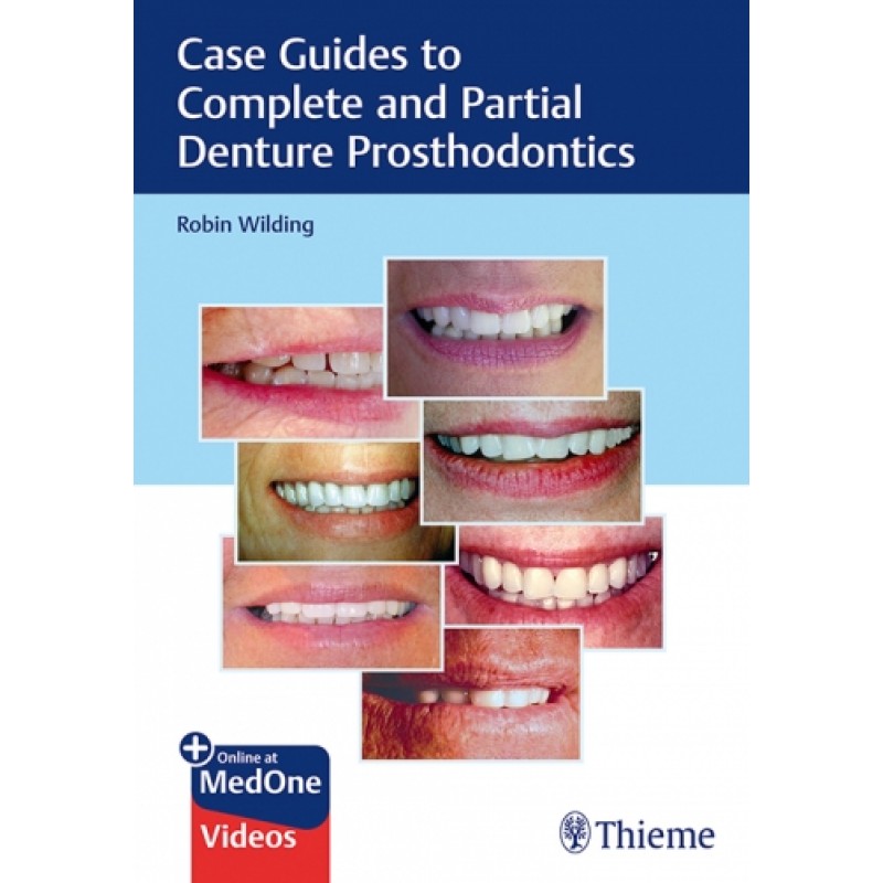 Case Guides to Complete and Partial Denture Prosthodontics