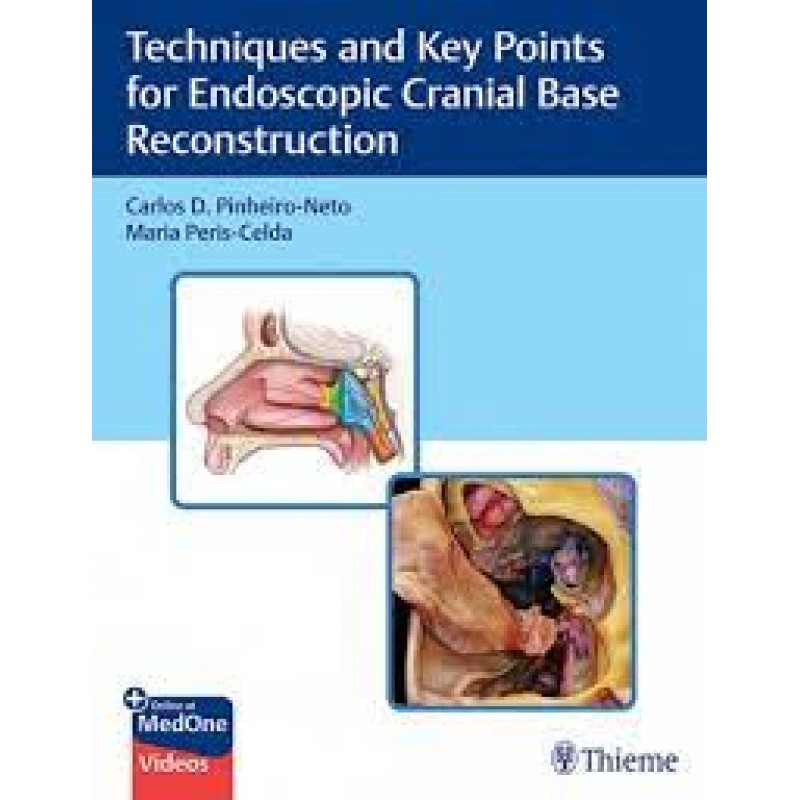 Techniques and Key Points for Endoscopic Cranial Base Reconstruction