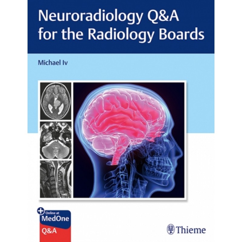 Neuroradiology Q&A for the Radiology Boards 