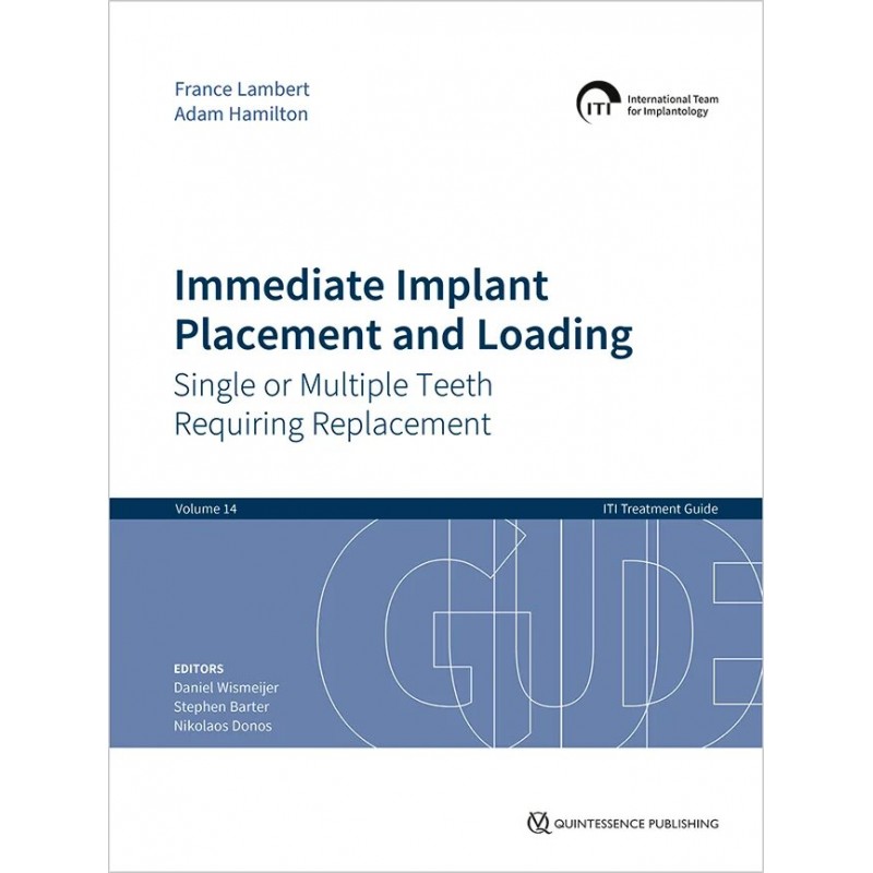 Immediate Implant Placement and Loading: Single or Multiple Teeth Requiring Replacement, 1st Edition