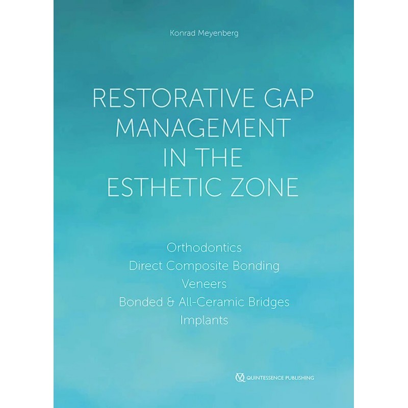 Restorative Gap Management in the Esthetic Zone: Orthodontics, Direct Composite Bonding, Veneers, Bonded & All-Ceramic Bridges, Implants, 1st Edition