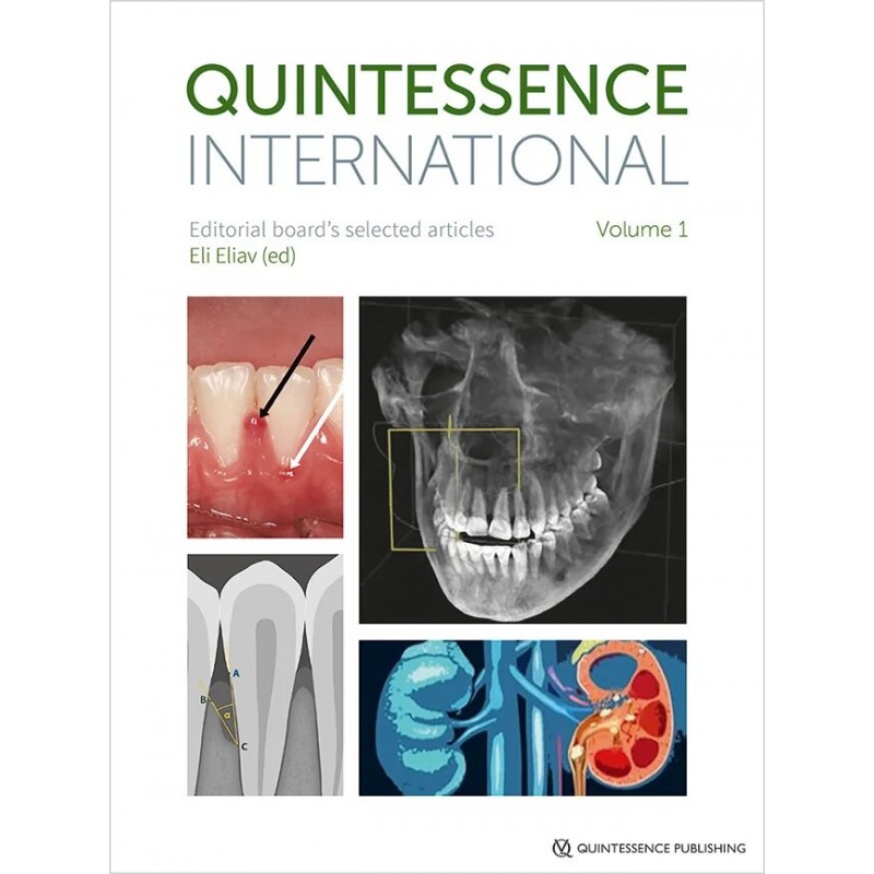 Quintessence International: Editorial board's selected articles, Volume 1