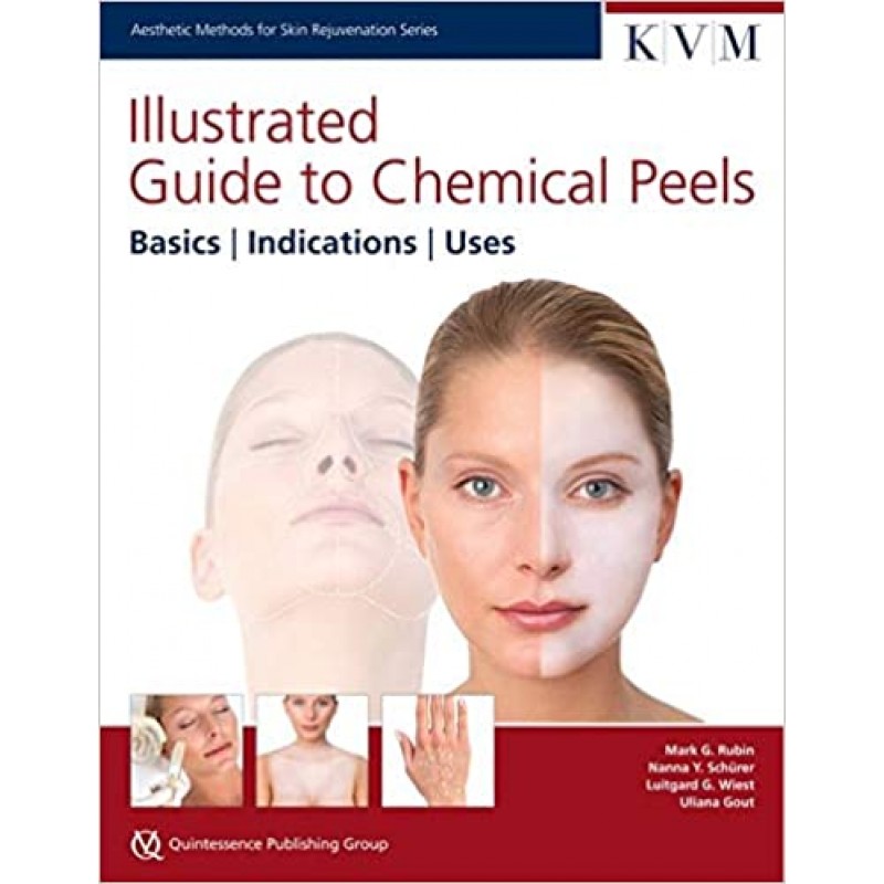  Illustrated Guide to Chemical Peels Basics | Indications | Uses