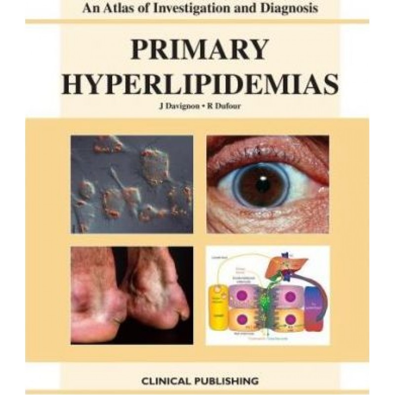 Primary Hyperlipidemias: Atlas of Investigation and Diagnosis