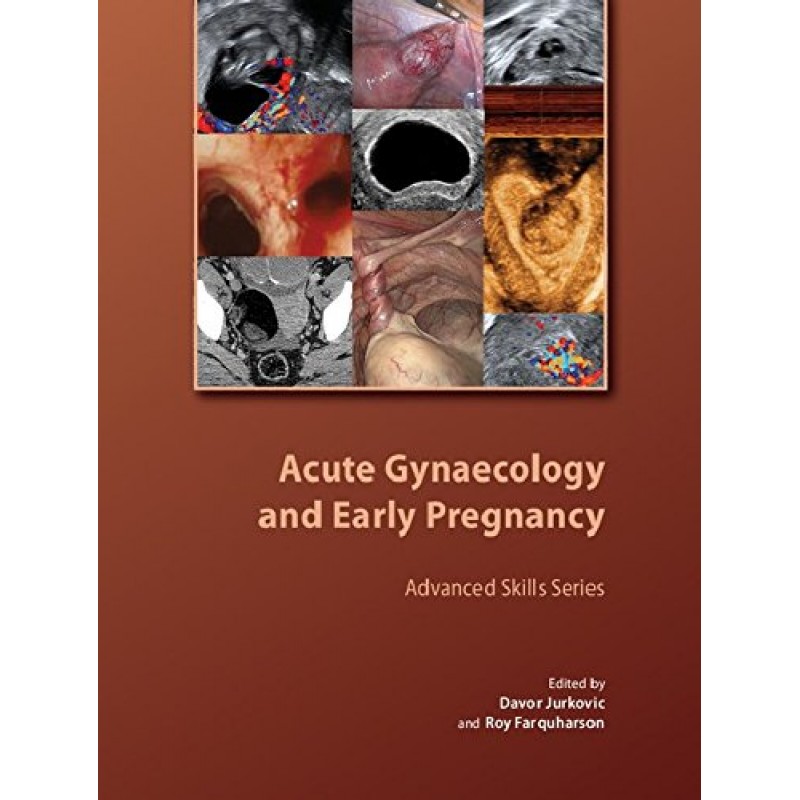 Acute Gynaecology and Early Pregnancy (Royal College of Obstetricians and Gynaecologists Advanced Skills)