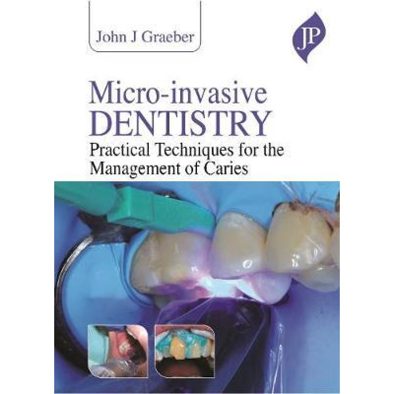 Microinvasive Dentistry Clinical Strategies and Tools