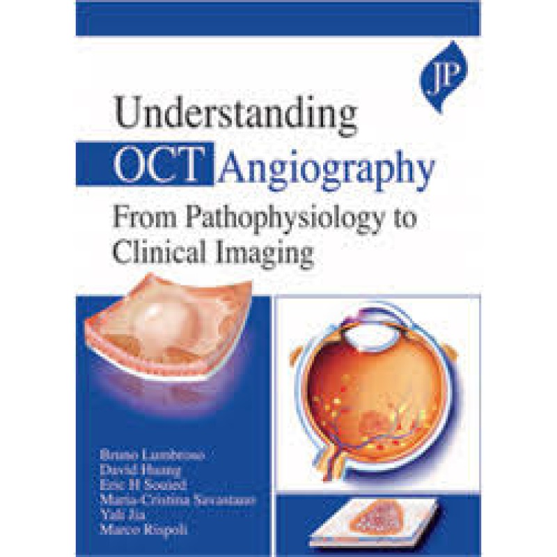 Understanding OCT Angiography: From Pathophysiology to Clinical Imaging