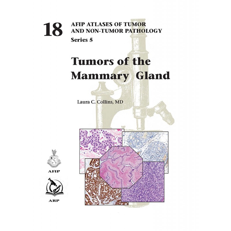 Tumors of the Mammary Gland