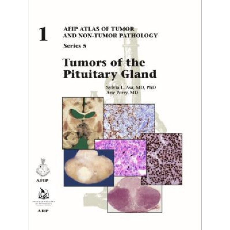 Tumors of the Pituitary Gland